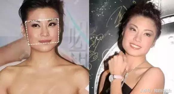 脸宽除了削骨还有什么办法,除了削骨还有什么办法让脸型流畅