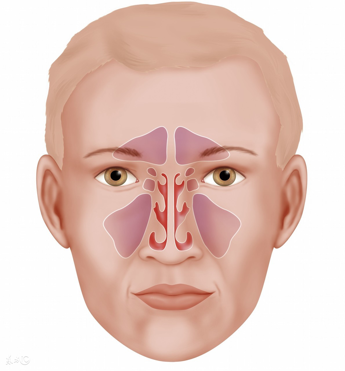 鼻炎鼻窦炎的最佳治疗,鼻炎和鼻窦炎的症状及治疗