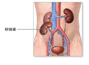 引起肾性贫血的5个原因,面色苍白贫血