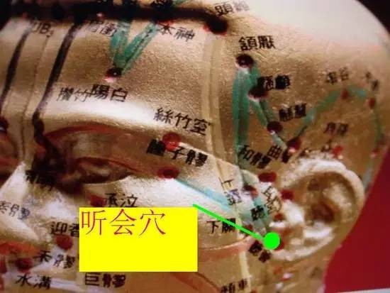 治疗手胀手麻的最佳方法,治疗手麻最好的方法是什么