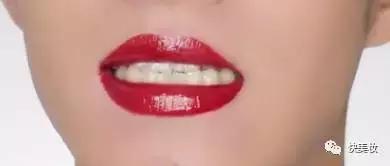 牙齿发黄是不是因为营养不良,牙齿黄被人嫌弃
