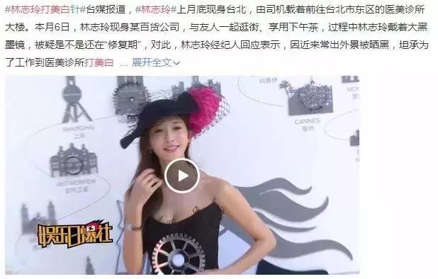 靠乖乖女一角走红却身边名裂，背后竟与整容有关