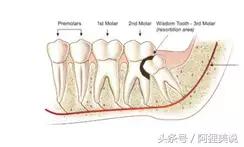 98%的人嘴里都有一颗“定时*弹炸**”，看看你中招了吗？