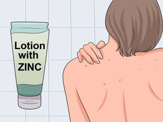 Freepure菲朴：背上长痘痘怎么办？7大杀招全解决