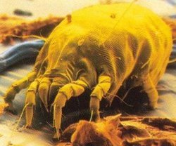 如何清理头螨,头螨长期在头上会发生什么