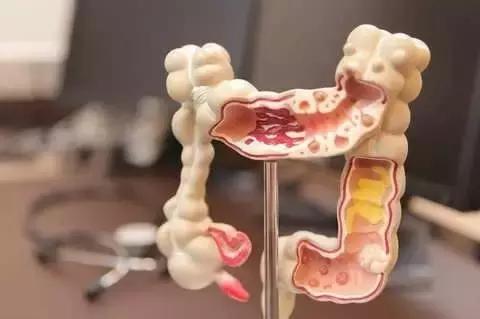 胃镜息肉切除后多久复查一次,体检检查出来胃息肉怎么办