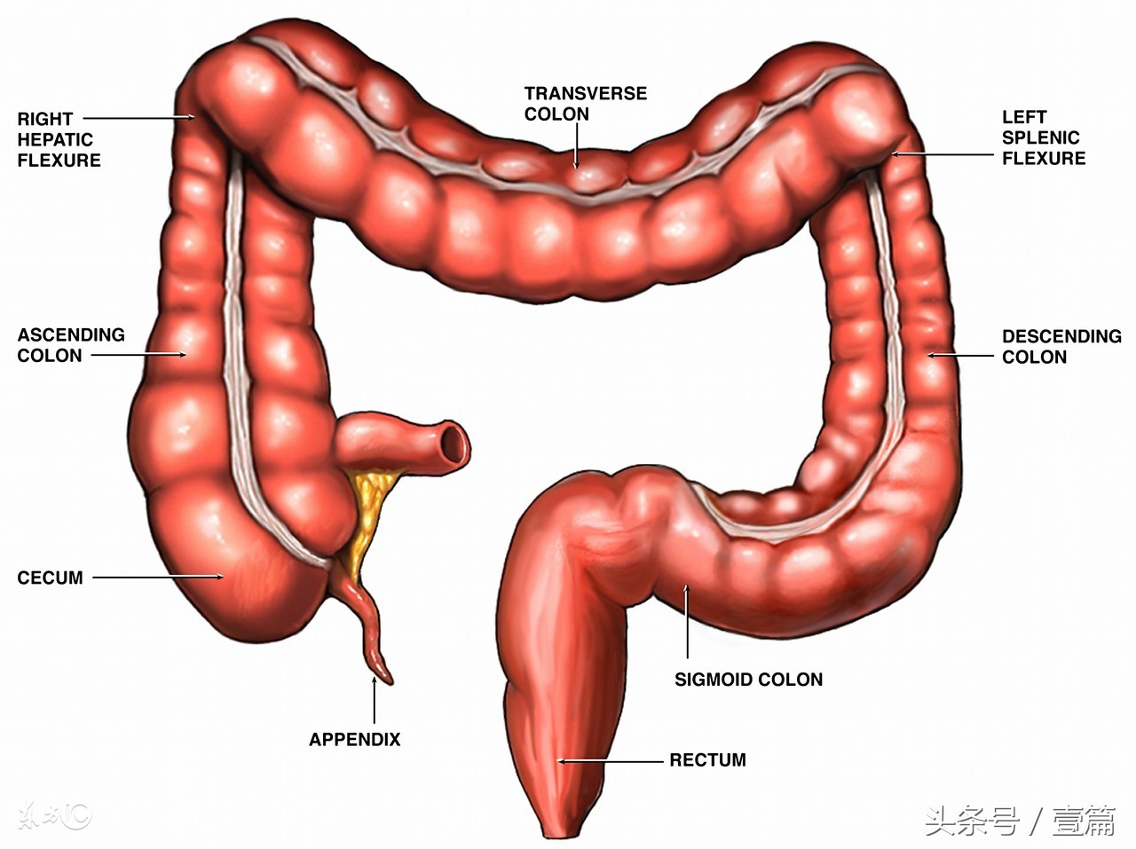 柳叶刀治疗结直肠癌,柳叶刀肿瘤消融治疗