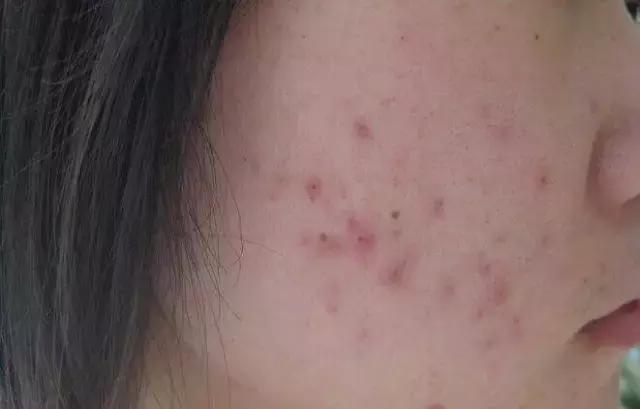 含矿物油的护肤品有什么危害,矿物油护肤品危害