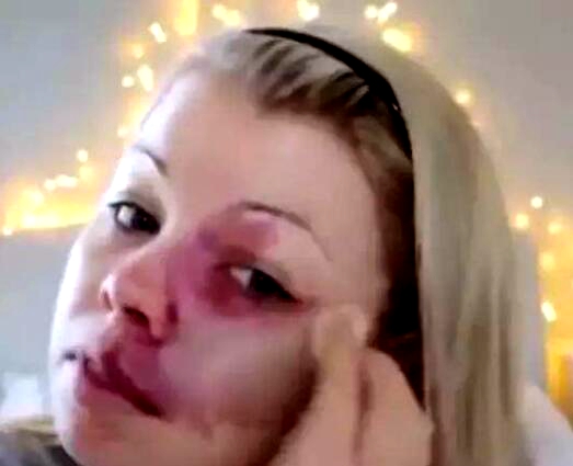 鑴镐笂鏈夎儙璁扮殑濂冲鍖栧褰╃粯,缁欎竴涓弧鑴歌儙璁扮殑濂冲鍖栧