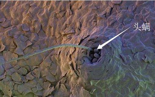 35岁美女大量掉发怎么办,22岁女掉发严重秃顶