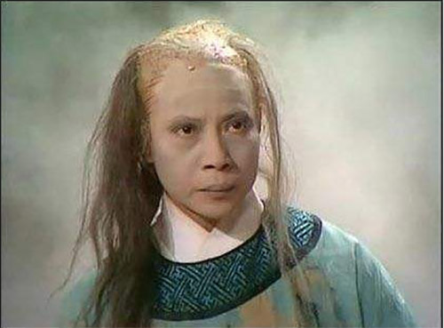 35岁美女大量掉发怎么办,22岁女掉发严重秃顶