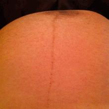 为什么妈妈会感觉到胎动,什么是胎动胎动是什么感觉