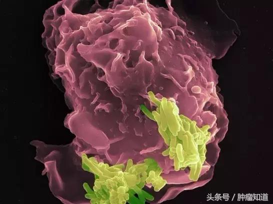 pd-1是什么制剂 (pd-1与pd-l的区别)