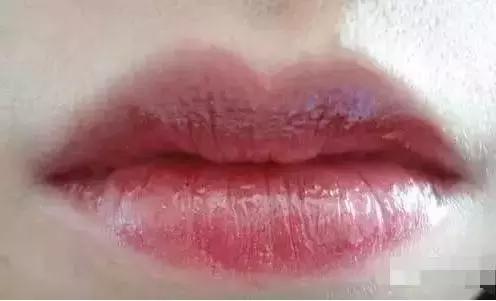 嘴唇变紫是心脏病吗,嘴唇变色是什么原因引起的