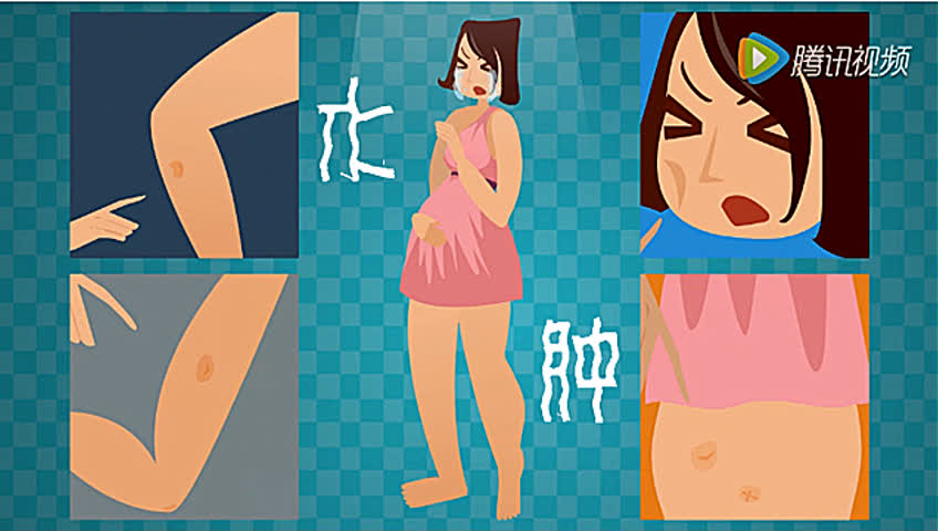 妊高症跟高原地区有关系吗,妊高症指数0.74严重吗