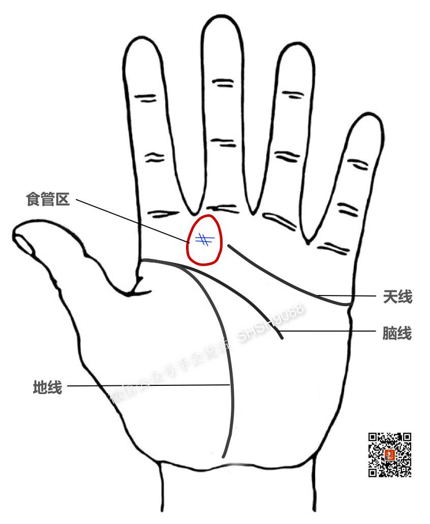 烧心感是什么感觉,心口嘈杂烧心是什么原因