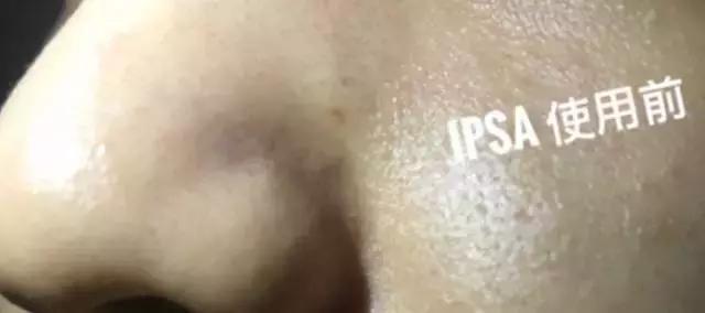 控油祛痘祛黑头粉刺闭口面膜推荐,哪种清洁面膜祛黑头粉刺有效果