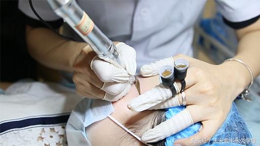 纹唇后的晕色期是什么意思,眉眼凹陷怎么修复