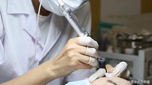 纹唇后的晕色期是什么意思,眉眼凹陷怎么修复