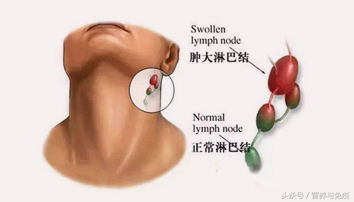58岁医生每天“打坐”20分钟,成功延长癌症存活期!