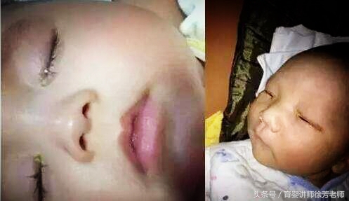 宝宝眼屎多是上火吗,宝宝眼屎多就是上火