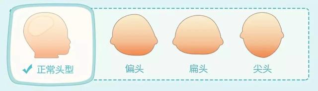 请问宝宝轻微偏头扁头怎么纠正,宝宝偏头头型怎么纠正