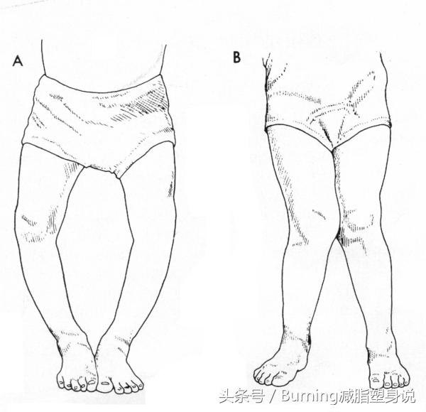 要做到这几点才能长高,上半身如何迅速长高