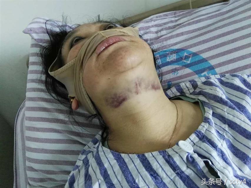 种植牙失败算医疗事故吗,种植牙医院医疗事故如何赔偿