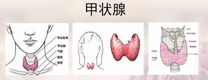 甲亢能彻底治愈吗怎么治,甲亢有遗传吗甲亢有什么症状