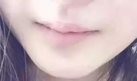 嘴唇变紫是心脏病吗,嘴唇变色是什么原因引起的