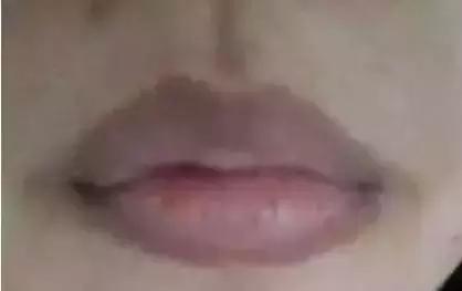 嘴唇变紫是心脏病吗,嘴唇变色是什么原因引起的