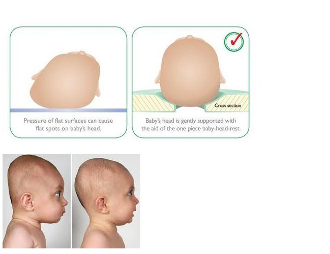 修剪发尖教程,三角梅修剪方法和技巧
