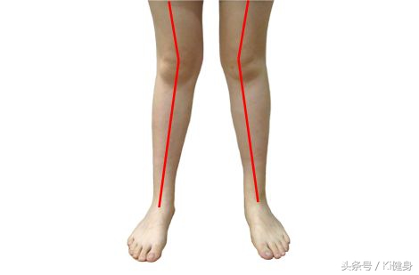 阔筋膜和阔筋膜张肌的区别,阔筋膜张肌和哪些肌肉为拮抗肌