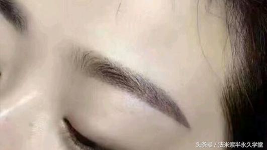 纹唇后的晕色期是什么意思,眉眼凹陷怎么修复