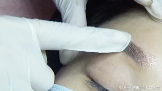 纹唇后的晕色期是什么意思,眉眼凹陷怎么修复