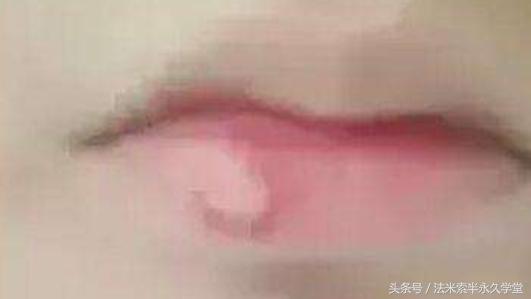 纹唇后的晕色期是什么意思,眉眼凹陷怎么修复