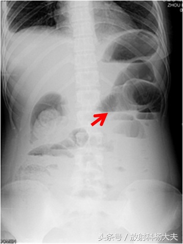 各种图像特征,千变万化的图像