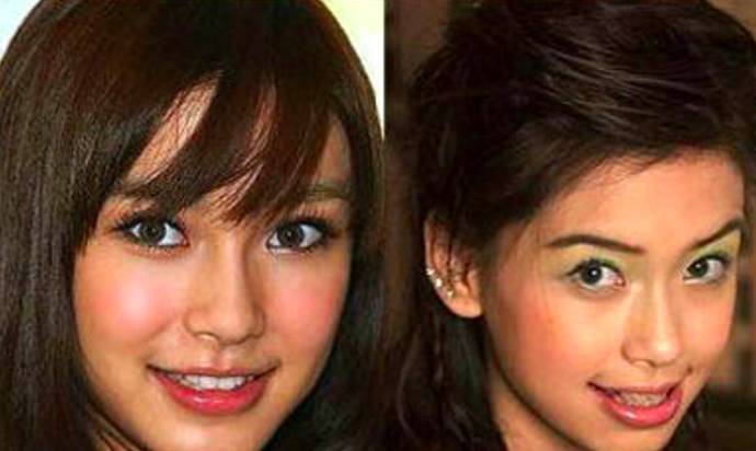 30岁淡化法令纹用什么精华,法令纹严重推荐精华