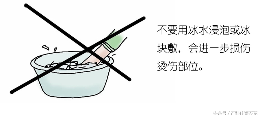 宝宝烫伤的家庭正确处理流程