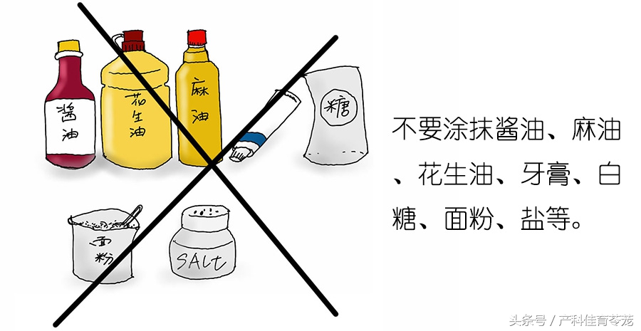 宝宝烫伤的家庭正确处理流程