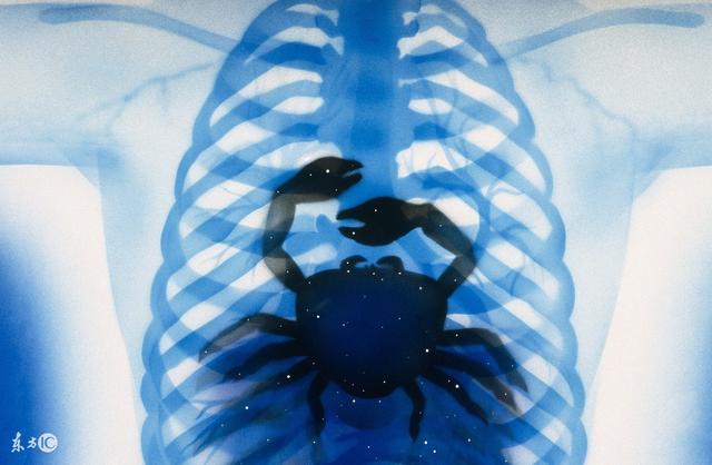 肺癌晚期食欲不振可以吃什么药,肺癌晚期食欲差能吃宜利治吗