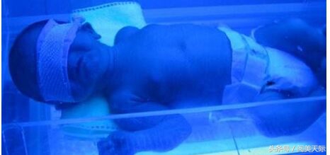 出生两天的宝宝就因黄疸被隔离,妈妈再见到孩子时忍不住大哭不止