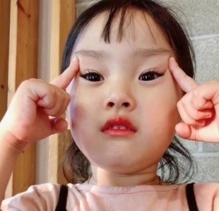 放疗后脸部水肿消肿最快方法,过敏眼睛水肿怎么快速消肿