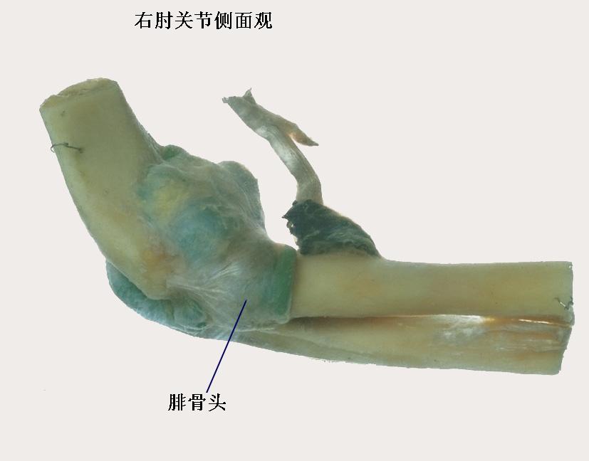 4岁左桡骨小头骨皮质断裂,小孩桡骨小头发育缺失