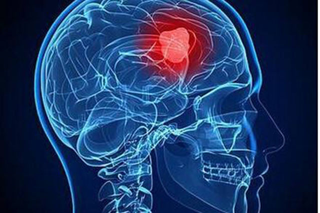 打嗝止不住是什么病的前兆,老年人打嗝脑中风的征兆