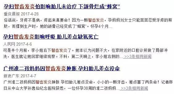 智齿到底要不要拔掉专家告诉你,80%的人智齿都需要拔除