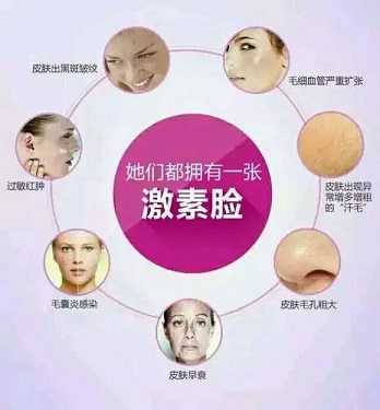 严重激素依赖性皮炎怎么治,出现激素依赖性皮炎怎么办