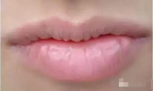 嘴唇变紫是心脏病吗,嘴唇变色是什么原因引起的