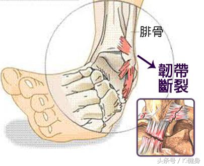 小腿肌肉ct解剖图,小腿肌肉解剖学讲解