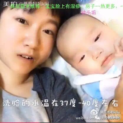 幼儿头垢和湿疹结痂的区别,湿疹洗澡用什么清洗